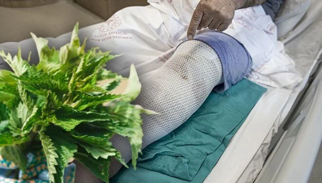Isırgan otu hastanelik etti!