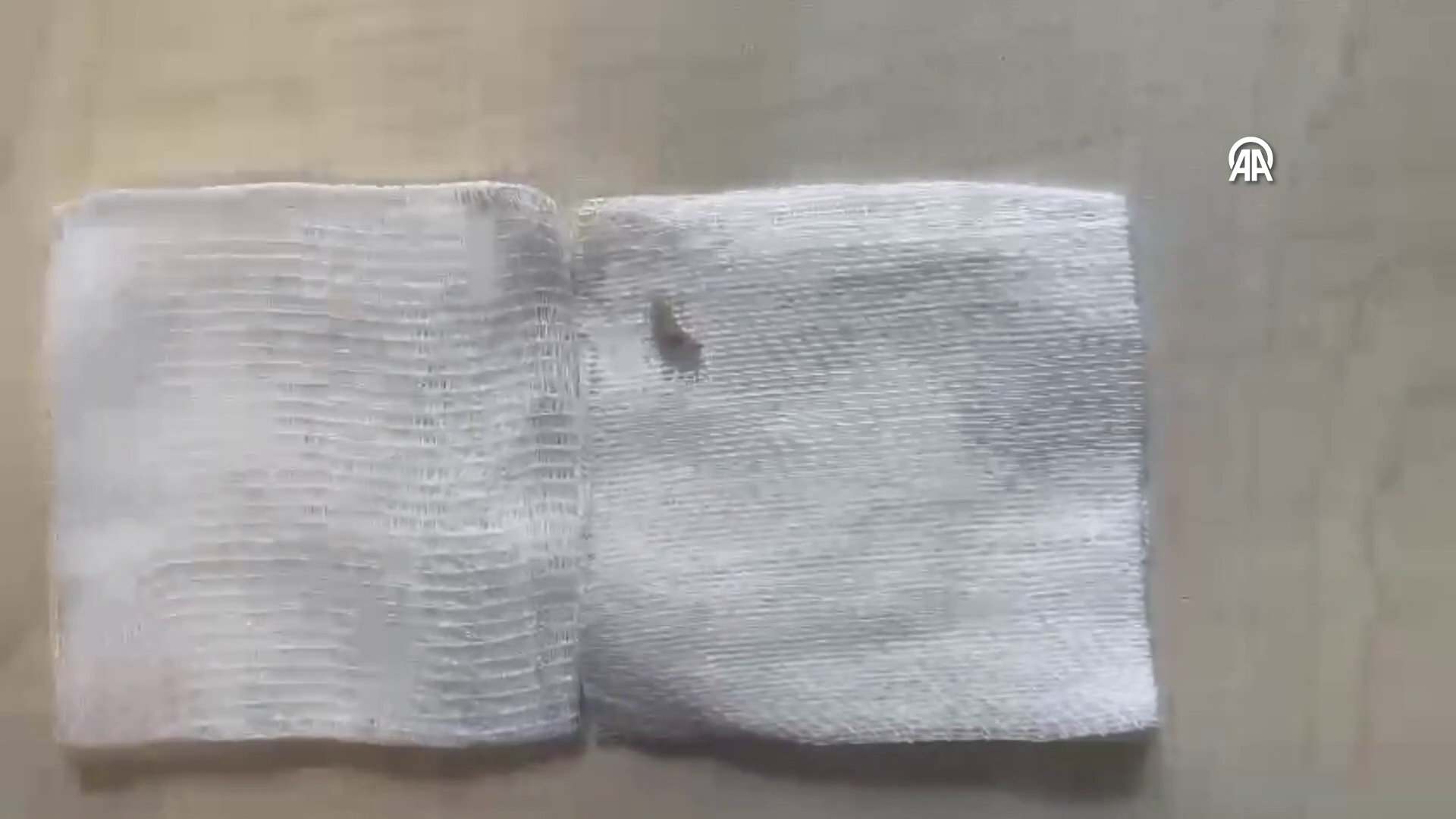 Kulağından 2 kurtçuk çıkarıldı