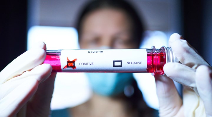 Covid-19 semptomları yine değişti !