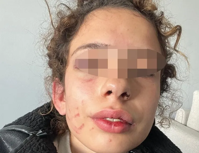 Ayrılmak isteyen genç kızı öldüresiye dövdü !
