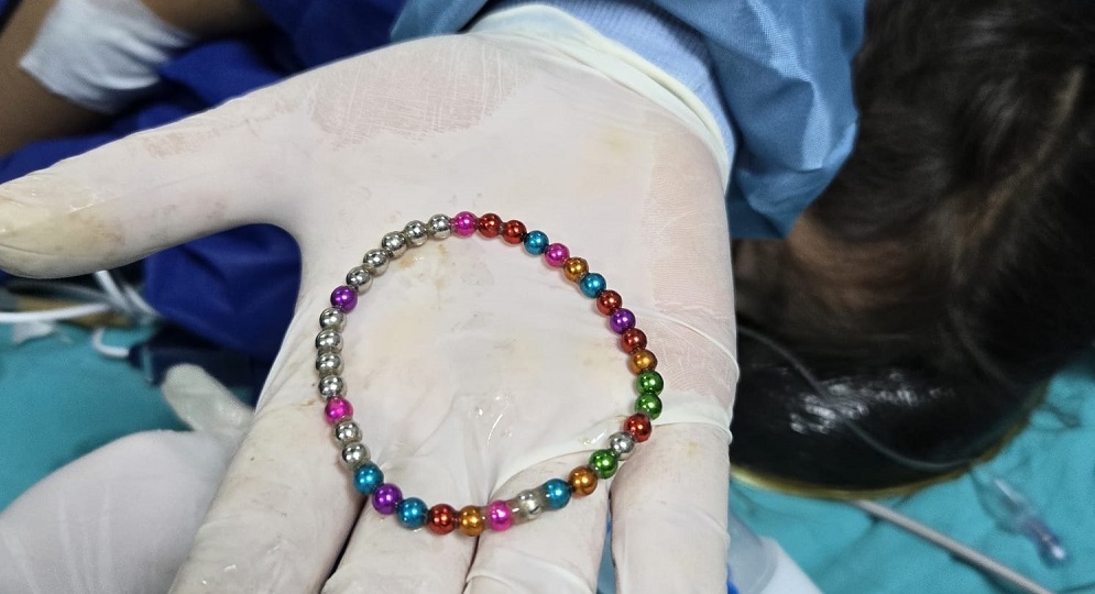 Bağırsağından 38 adet boncuk çıkarıldı