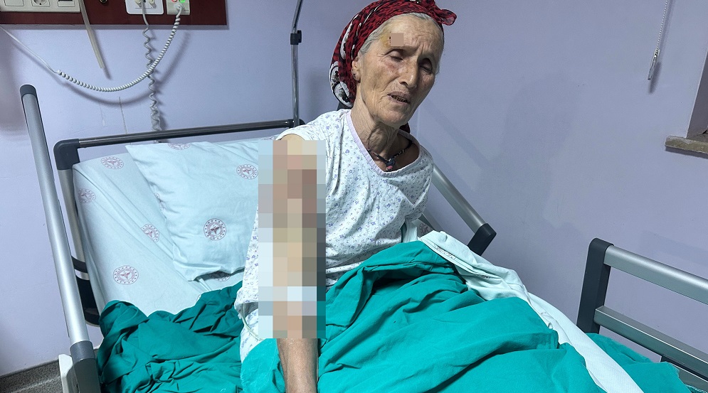 65 yaşındaki kadına 7 köpek saldırdı