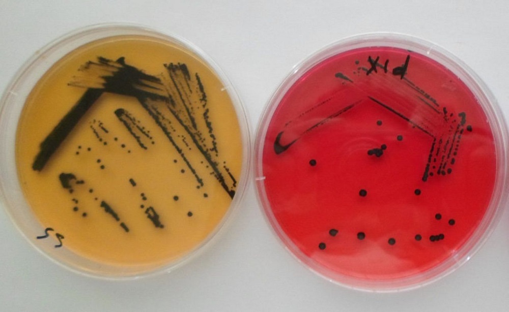 Salmonella bakterisine dikkat