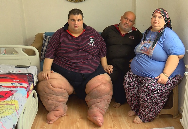 270 kiloya ulaştı evden çıkamıyor