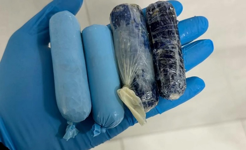 Vücudundan 140 gram uyuşturucu çıktı