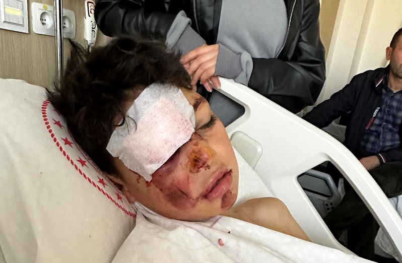 Bisikletli çocuğa çarpıp kaçtı