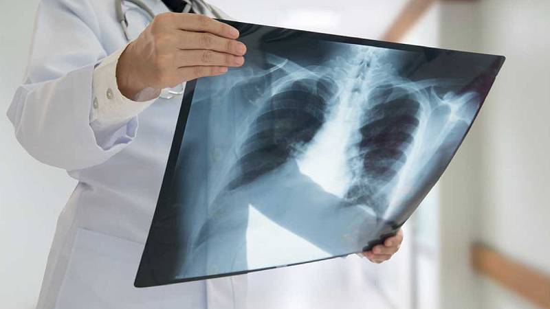 Uzmanlardan 'süperenfeksiyon' uyarısı