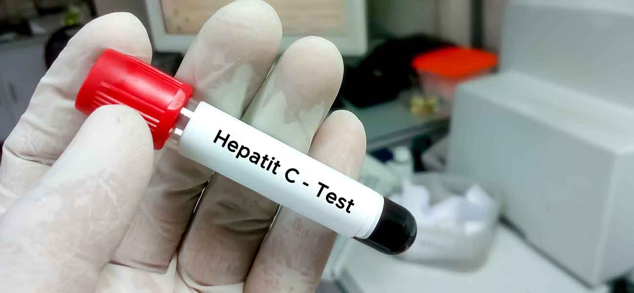 Hepatit C aramızda mı geziyor!