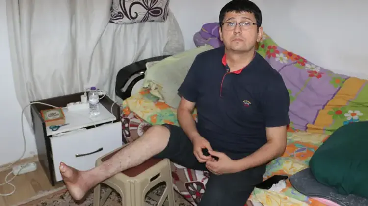 19 yıldır ayağındaki yaraya çare arıyor