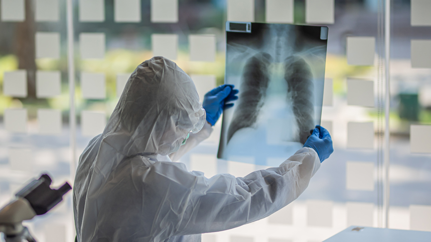 3 Ekim 2021 corona virüs tablosu